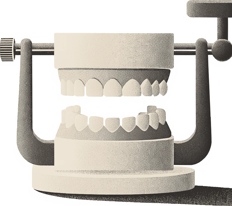 Ilustração de um modelo de gesso da arcada montado em articulador de bancada